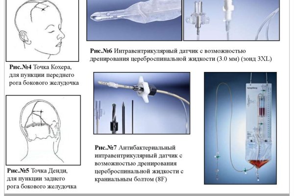 Сайт кракен что это такое